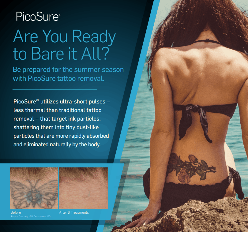 picosure laser tattoo removal chicago aesthetics med spa